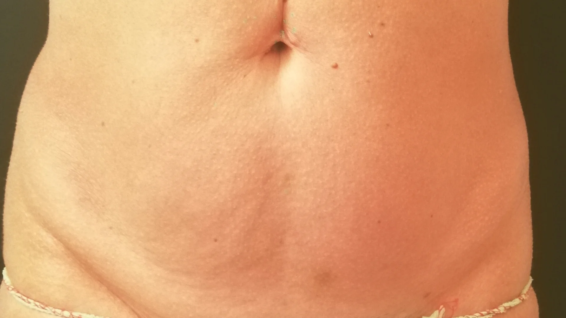 definizione corpo dopo