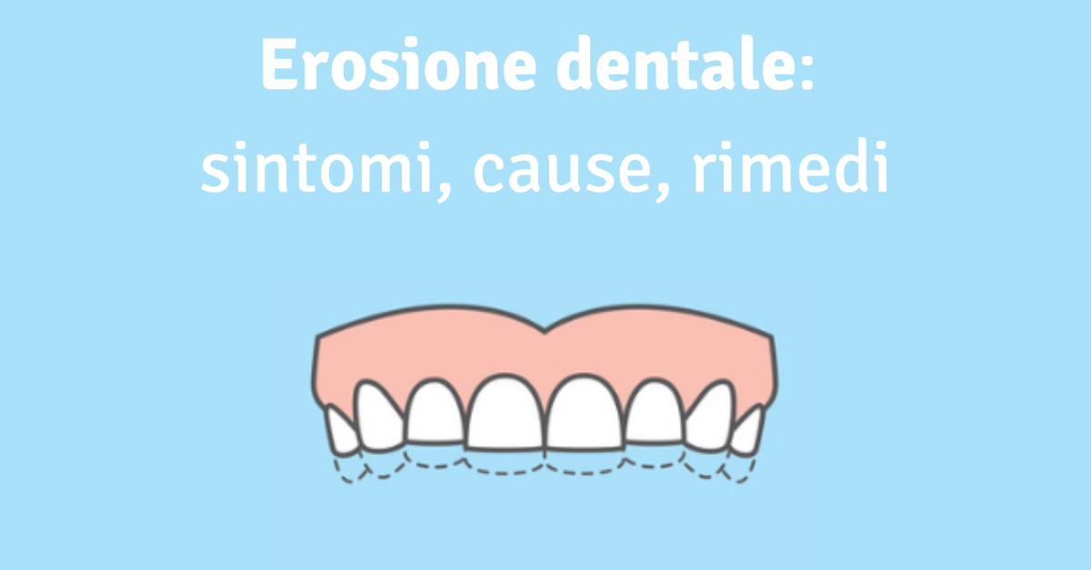 Erosione dentale: sintomi, cause, rimedi