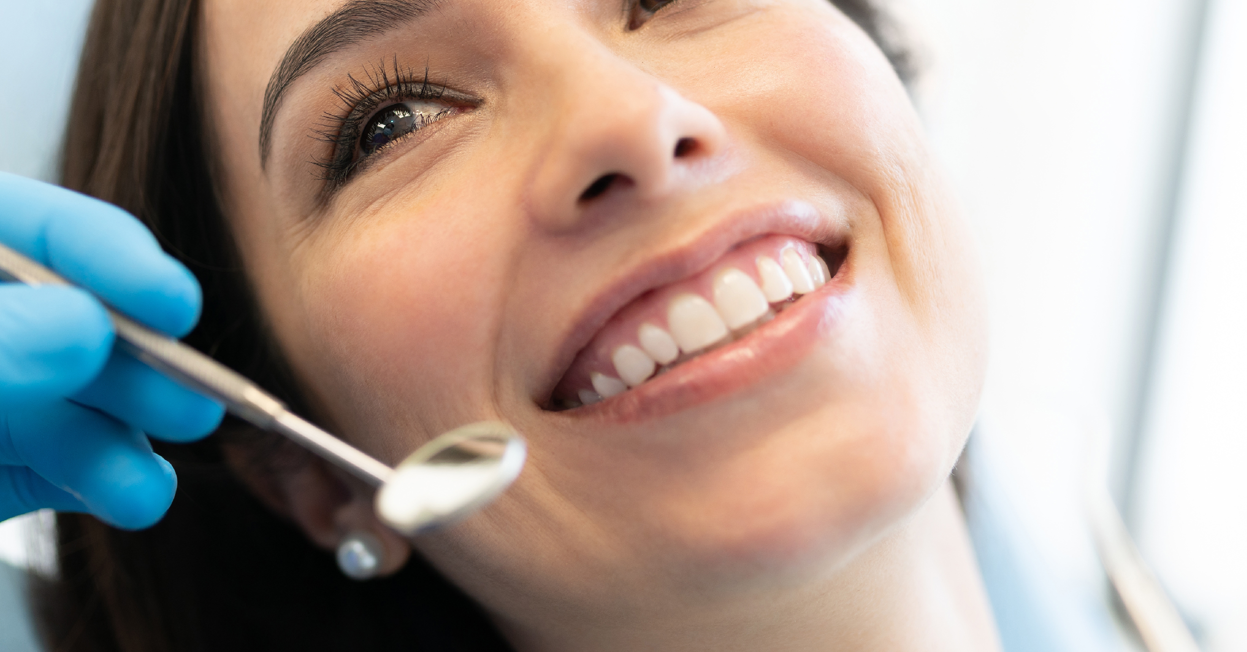 Guarire dalle carie con la remineralizzazione dentale